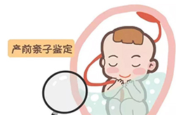 苏州孕期亲子鉴定要如何办理，苏州产前亲子鉴定中心预约流程